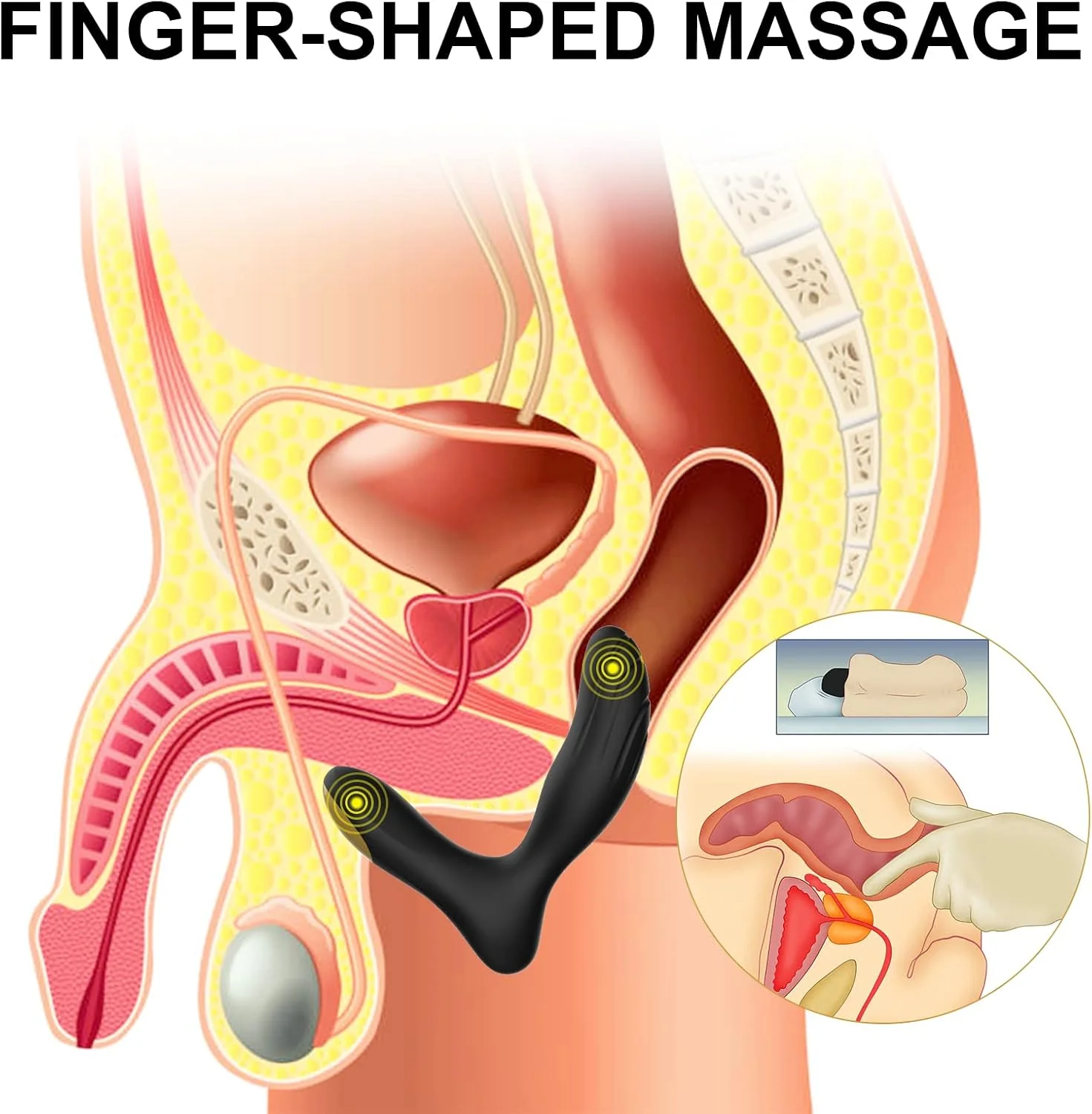 NovaReach Vibrating Remote Control Prostate Massager - Image 3