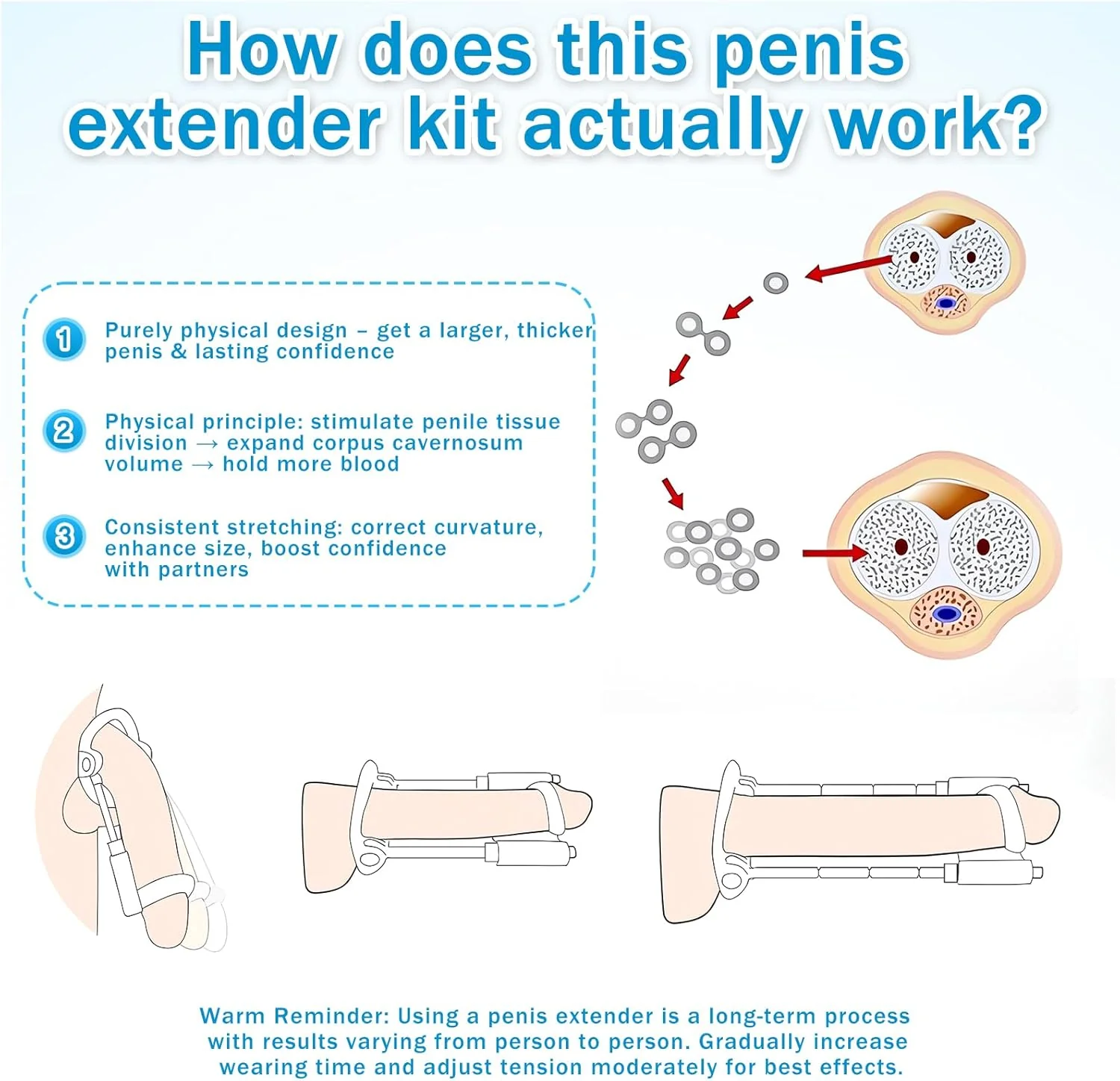 FlexCorePro Penis Extender Adjustable Traction Device - Image 5